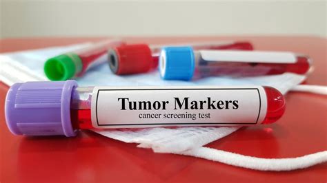 tumor marker test dropped 100 points since first chemo|cancer markers low.